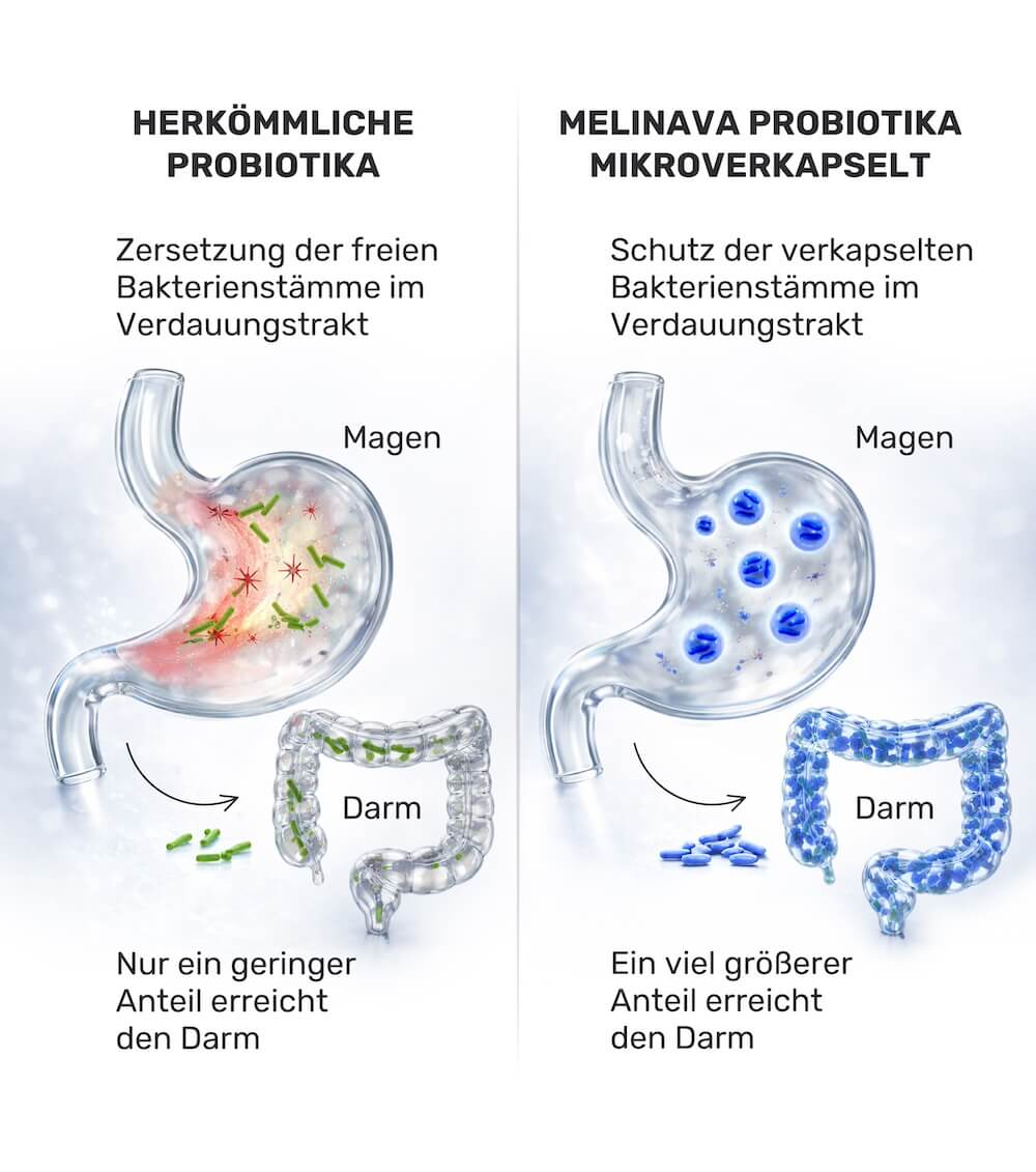 Vergleich herkömmliche Probiotika und Melinava Probiotika Mikroverkapselt: Schutz der Bakterienstämme im Verdauungstrakt