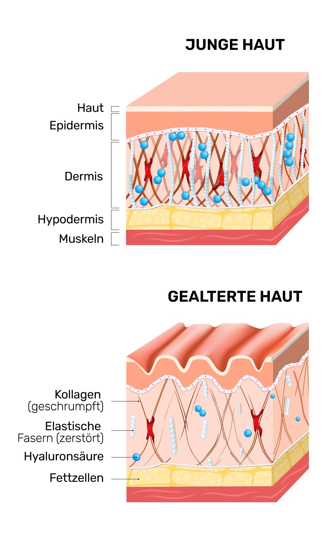 Junge Haut und gealterte Haut im Querschnitt: Kollagen, elastische Fasern, Hyaluronsäure und Fettzellen